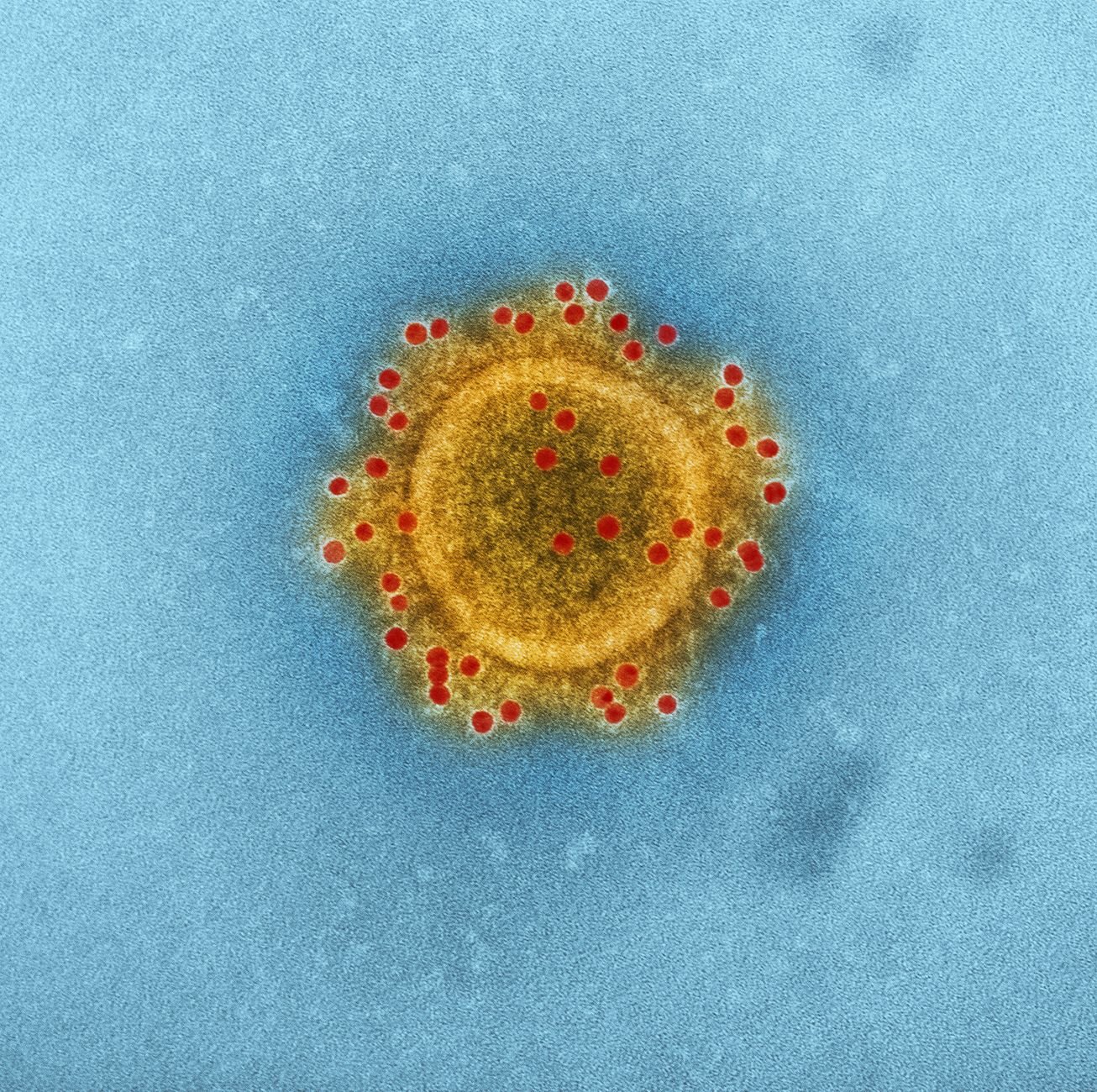 High-resolution image of coronavirus particle under electron microscope.